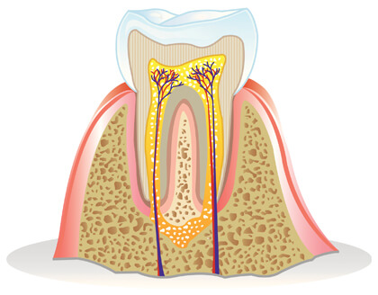 Affordable Root Canal Cardiff, Bay House Dental Practice
