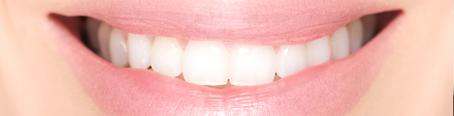 teeth whitening